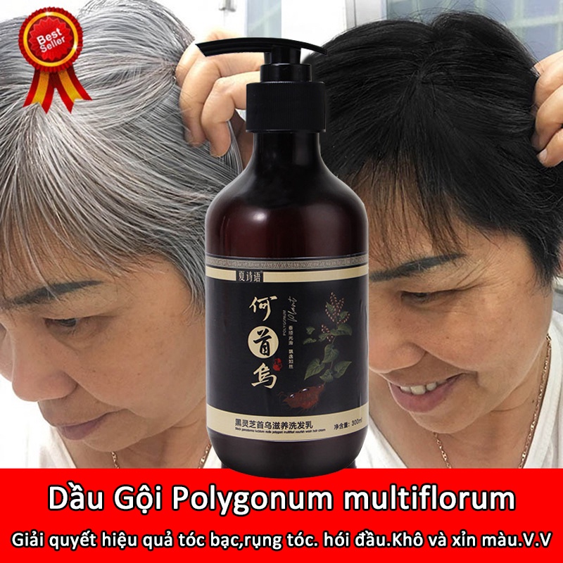 Dầu gội mọc tóc nhanh dài chăm sóc tóc dưỡng tóc giảm rụng tóc thúc đẩy mọc tóc an toàn chống rụng tóc 300ml