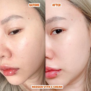 Serum Vitamin C Neogen 22% - 30ml