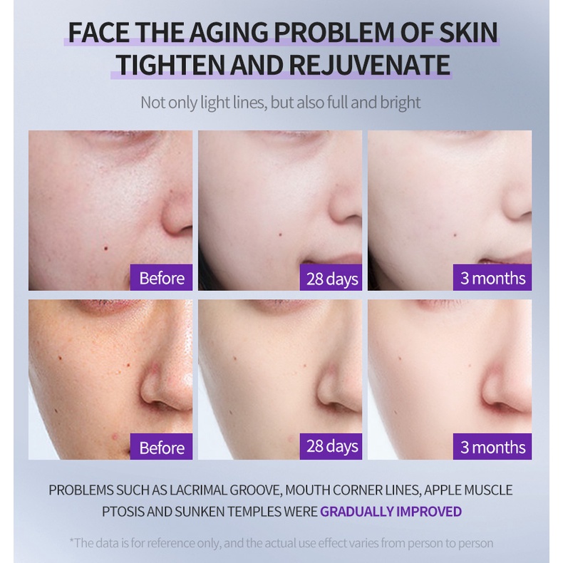 DEleventh Boseine Ceramide Serum Ngăn Ngừa Lão Hóa - Serum dưỡng ẩm xóa nếp nhăn
