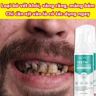 Bọt trắng răng Kem đánh răng Mousse làm trắng răng Vệ sinh răng miệng khử mùi hôi miệng Giảm Ố Vàng Loại Bỏ Mùi Hôi Mảng