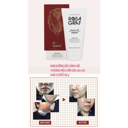 Kem dưỡng ROSAGRAF Forty Plus Up Cream 150ml Bebalance