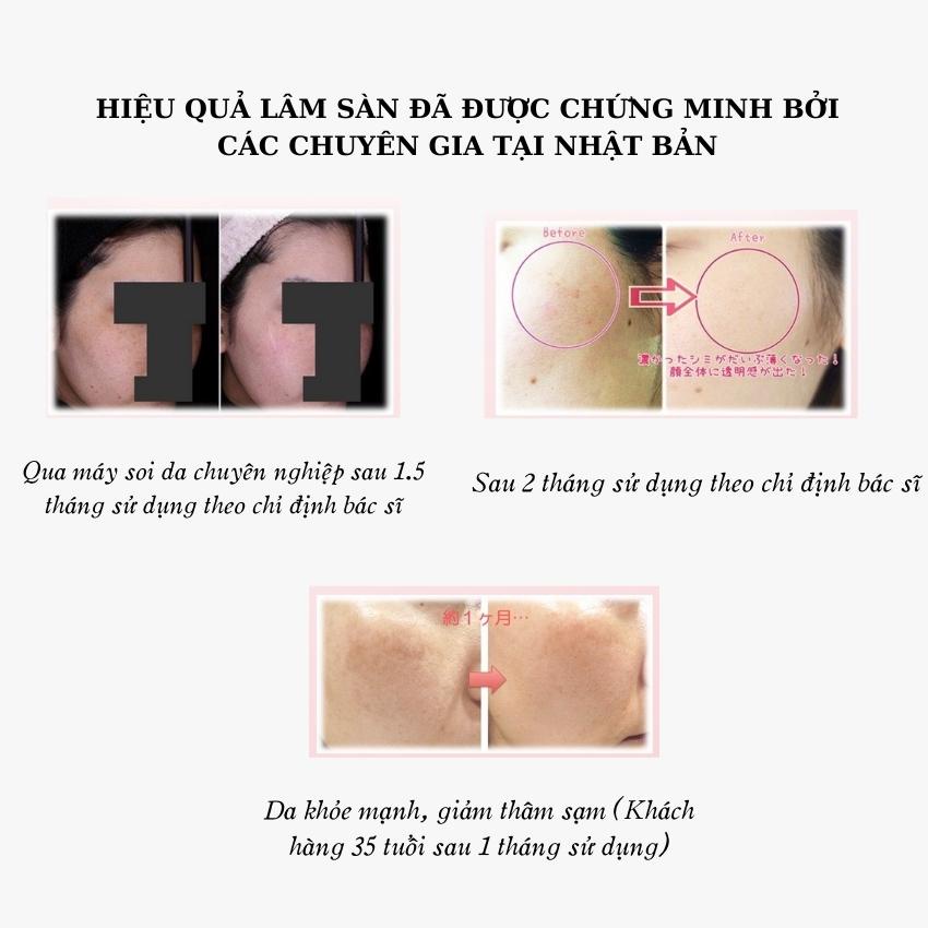 Viên uống trắng da và chống nắng nội sinh FRESA  WHITENING & SUNBLOCK  hộp 90 viên Nhật bản mẫu mới 2023