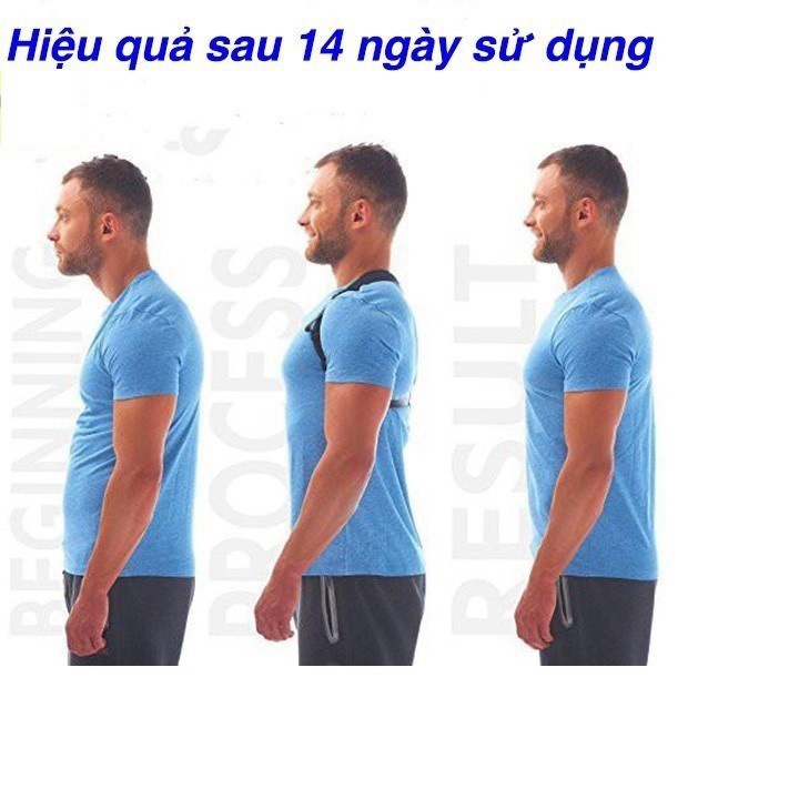 Đai chống gù chỉnh hình cột sống