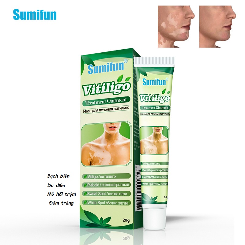 Kem Bôi da Lang Ben, Bạch Biến, Đốm Trắng, Mồ Hôi tay, thành phần thảo dược thiên nhiên 100%