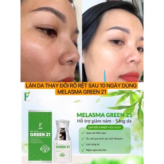 MELASMA GREEN 21 - PHAN AN GREEN