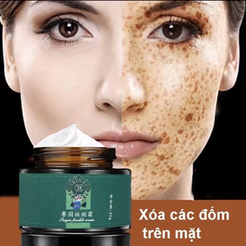 Kem mờ nám , tàn nhang đốm nâu hàng nội địa Trung