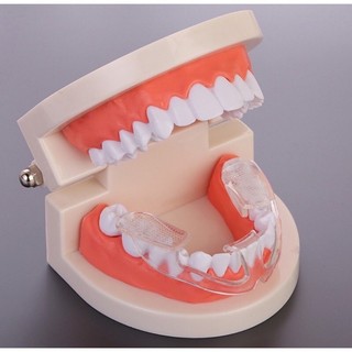 Máng chống nghiến răng siêu mềm, dụng cụ bảo vệ răng khi ngủ bằng silicon