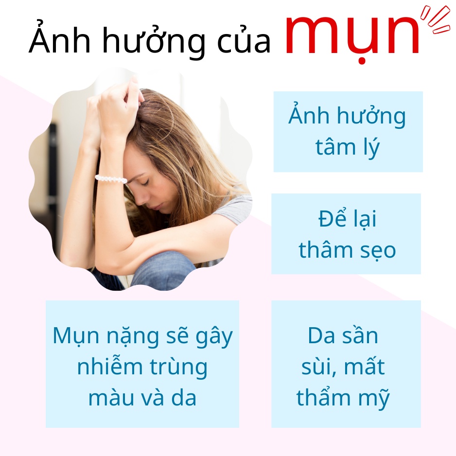 Kem gel bôi mụn Feelex ByeMun giảm mụn ẩn, mụn đầu đen, mờ thâm thích hợp với mọi loại da - Tuýp 15gram