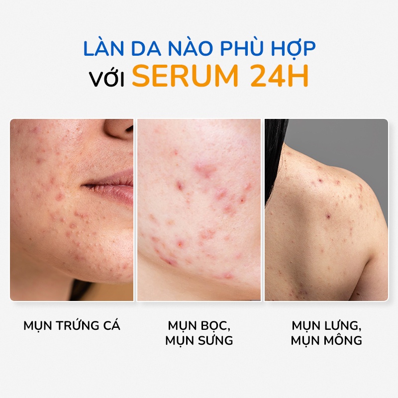 Serum Giảm Mụn Và Thâm Cấp Tốc 24H Tinh Dầu Tràm Trà Úc Anti Acnes NEOSKIN 20ml
