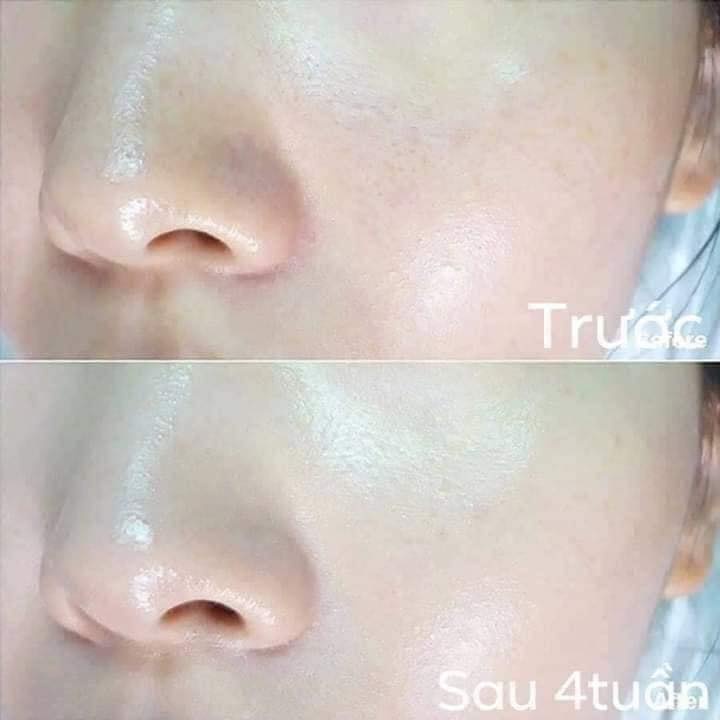 Combo 10 Gói Ohui The First Brightening Dual Serum Huyết Thanh Dưỡng Trắng Da, Chống Lão Hóa, Căng Bóng Da