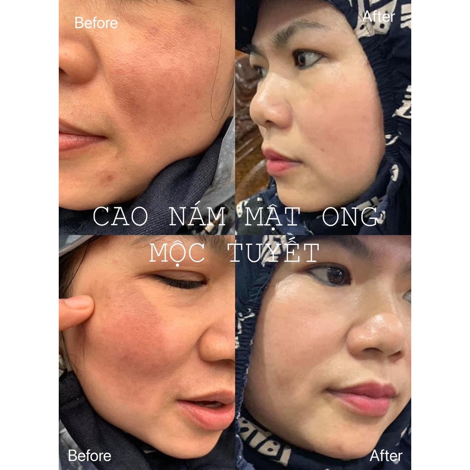 Kem dưỡng ngày giảm thâm nám & sáng da Mộc Tuyết 50ml | BigBuy360 - bigbuy360.vn