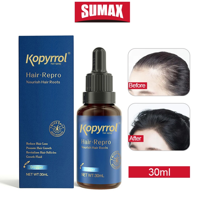 Tinh chất kích thích mọc tóc SUMAX 5% hỗ trợ tóc mọc dày và chắc khỏe hơn 30ml