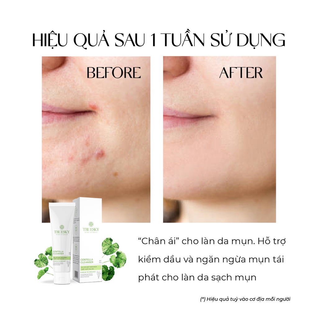 Gel rửa mặt ngăn ngừa mụn Truesky Centella Cleanser chiết xuất rau má 50g - Truesky Việt Nam