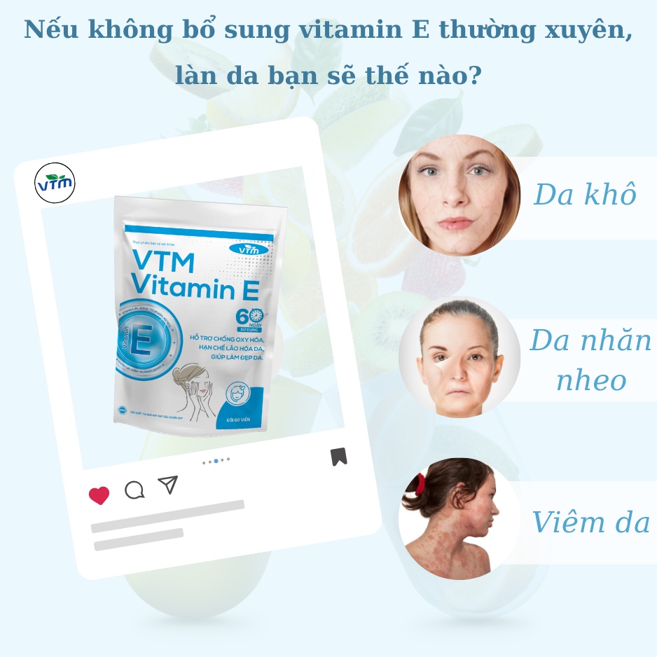 Viên uống bổ sung vitamin E VTM tăng cường sức khỏe, hỗ trợ chống oxy hóa, lão hóa da, giảm cứng khớp, tránh cảm lạnh