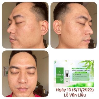 MELASMA GREEN 21 - PHAN AN GREEN