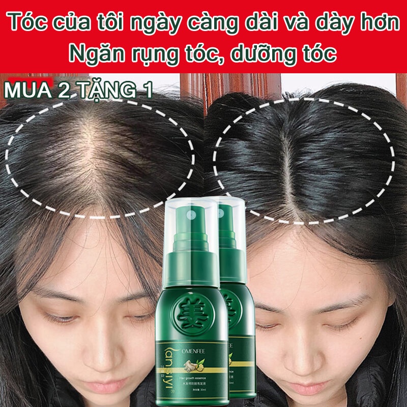 Tinh dầu mọc tóc nhanh,dau dưỡng tóc,serum mọc tóc,ngăn ngừa rụng tóc hair oil grow 30ml kích mọc tóc