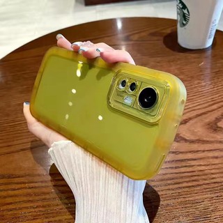 ốp lưng Redmi Note 9 Pro Note 9S Note 10 4G Note 10S Note 10 Pro 4G Note 11 Note 11S Note 11 Pro 4G 5G Note 11 Pro Plus 10 5G Note 10 5G Vỏ điện thoại di động chống rơi trong suốt