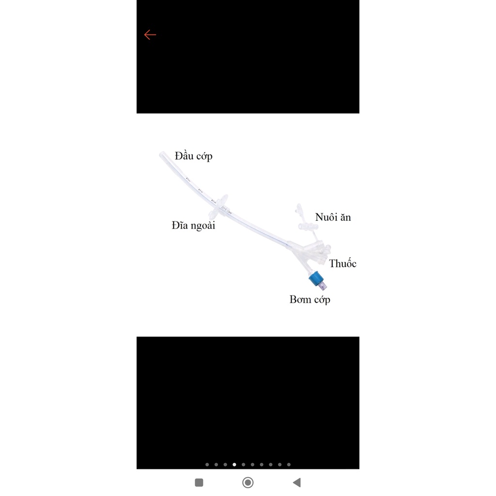 Ống sonde silicone mở thông dạ dày-dùng cho bệnh nhân mở thông dạ dày