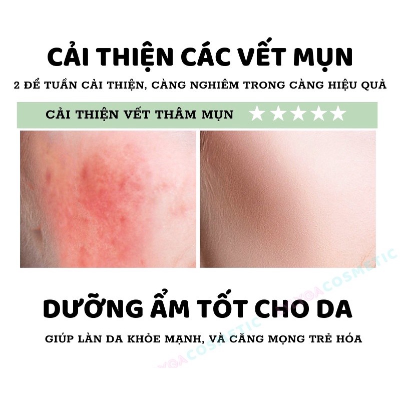 Gel Nha Đam dưỡng ẩm 99% FAZIYAN - Gel Lô Hội nội địa Trung dưỡng da, cấp ẩm cho da mặt 30gr
