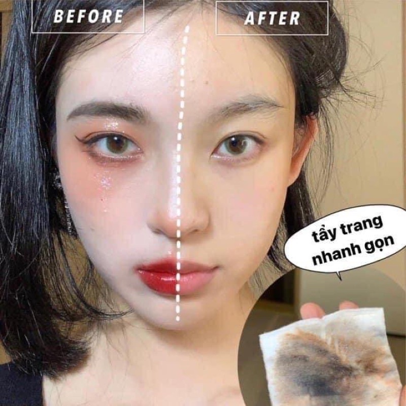 Nước Tẩy Trang Cho Da Nhạy Cảm, da dầu mụn Chacott 500ml LS