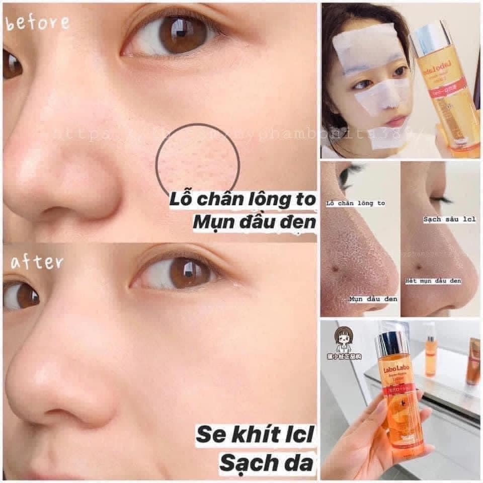 Toner Labo Labo Nhật 100ml