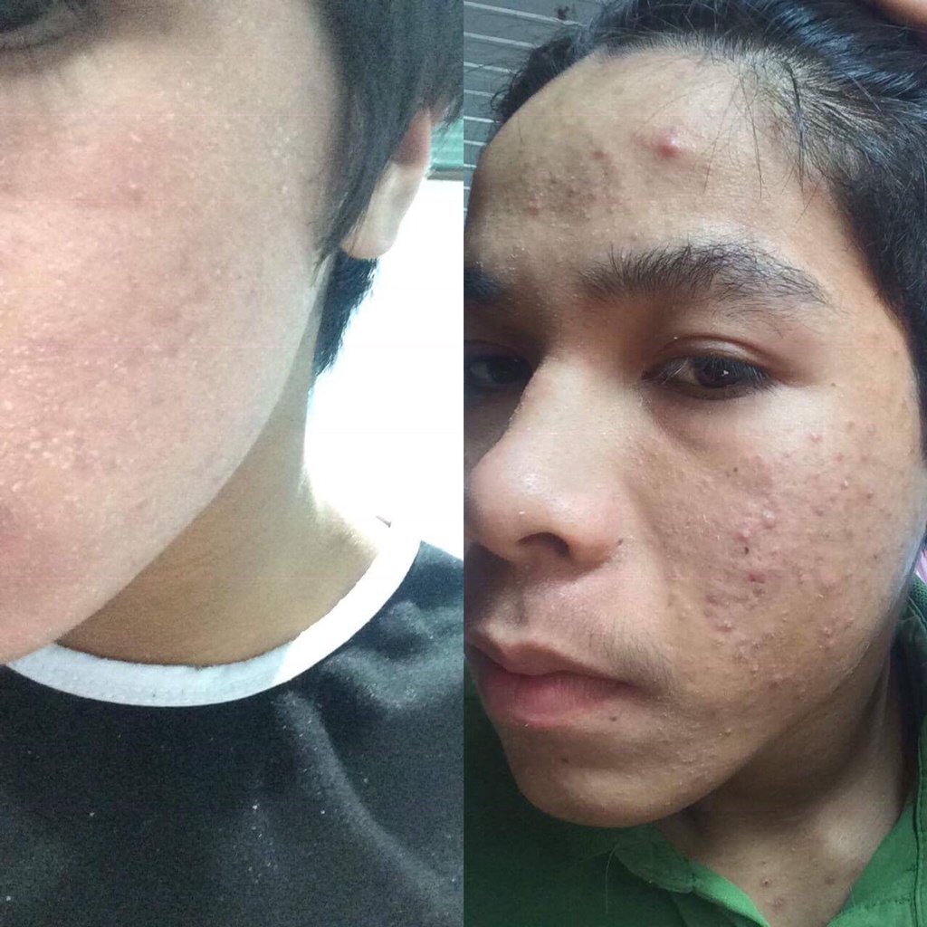 Thảo dược gia truyền tái tạo da 💗Tái tạo da Toner Organic 125ml