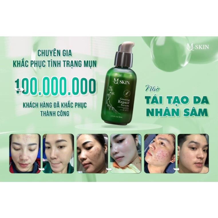Serum Thay Da Nhân Sâm Củ Chính Hãng