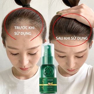 xịt mọc tóc Tinh chất mọc tóc Serum chống rụng tóc Nuôi dưỡng chân tóc mái tóc mỏng thưa Cải thiện nang tóc Tóc dày Chăm