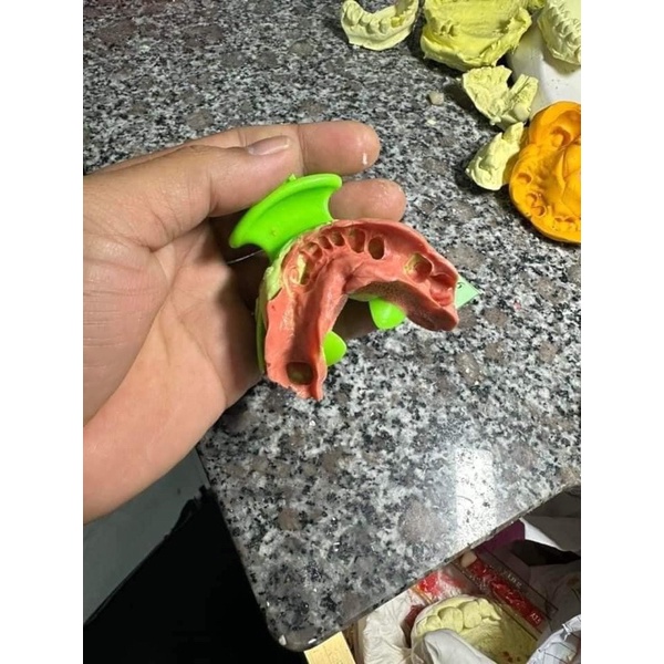 BỘ THÌA LẤY DẤU TƯƠNG QUAN TÂM - KHAY LẤY DẤU THÁO LẮP