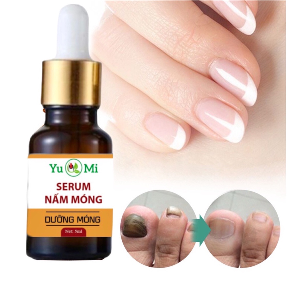 SERUM NẤM MONG TAY CHÂN