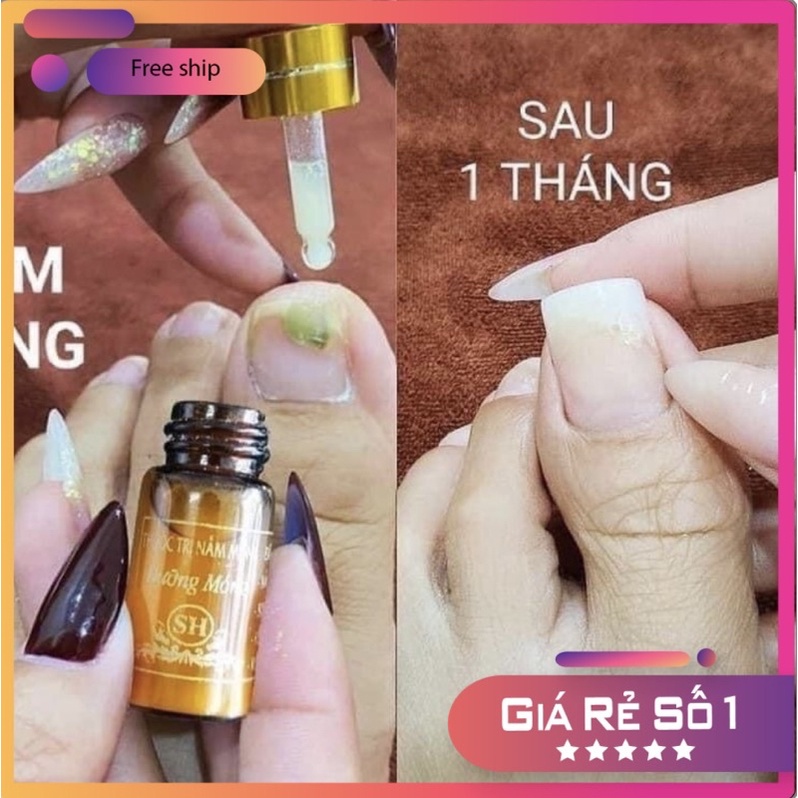 Nấm Móng Và Hủ Dưỡng  HÀNG CHÍNH HÃNG