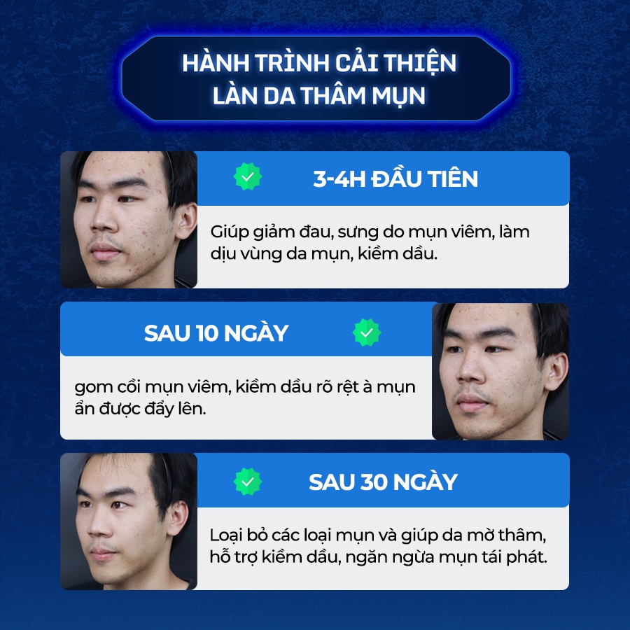 Combo Giảm Mụn Mờ Thâm Dành Cho Nam Giới The Menco Zinc White Acne 10ml và Lightening Serum 30ml