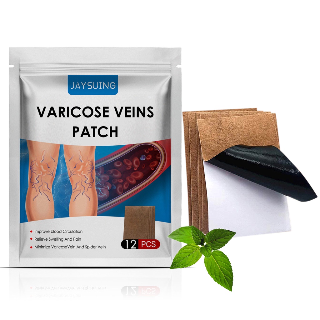 Bài chữa tĩnh mạch đăng giảm đau sưng chân giun đất chữa phình gân xanh chữa cao dán