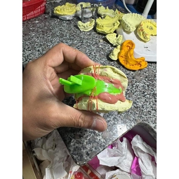 BỘ THÌA LẤY DẤU TƯƠNG QUAN TÂM - KHAY LẤY DẤU THÁO LẮP