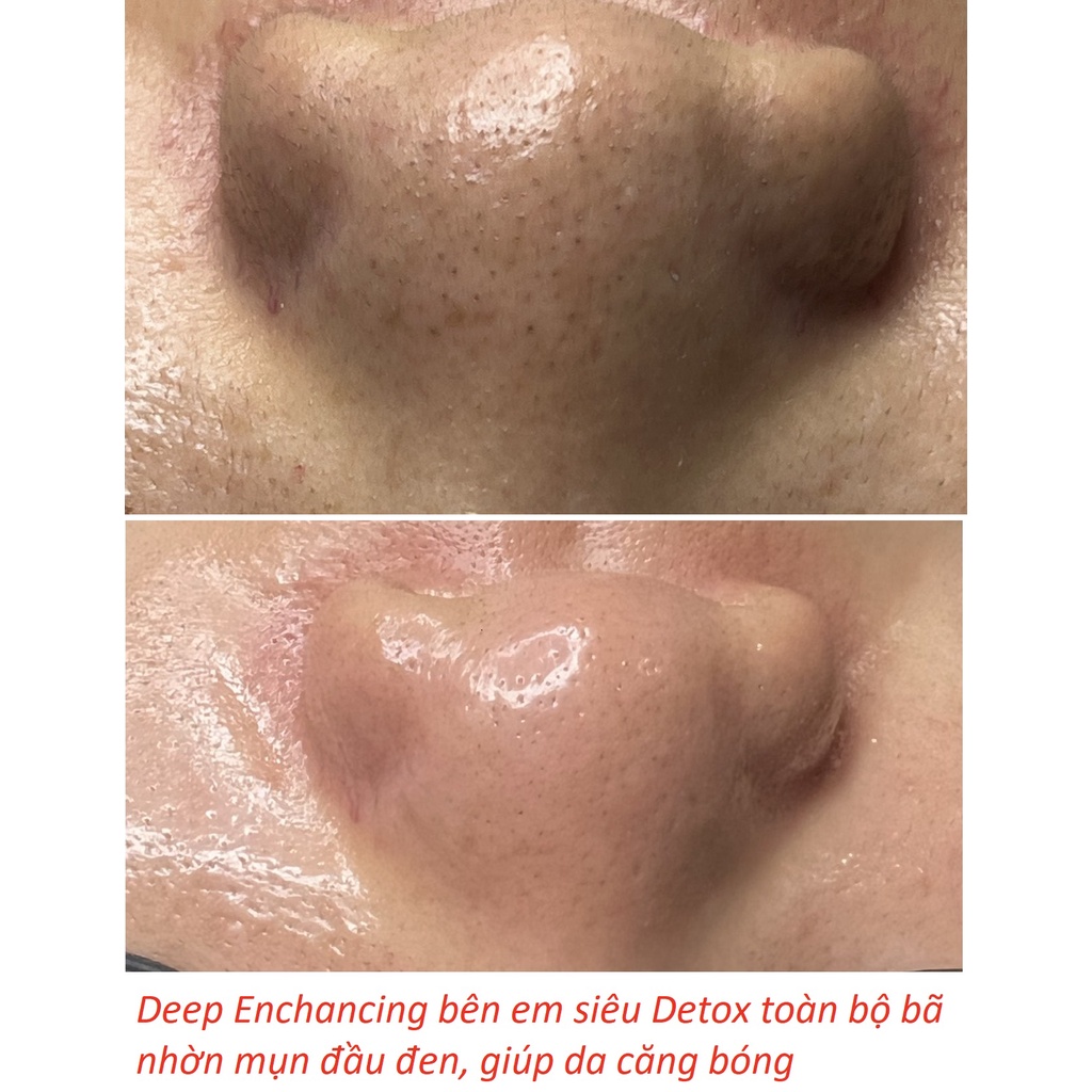 Cây Cà Mụn Châu Âu