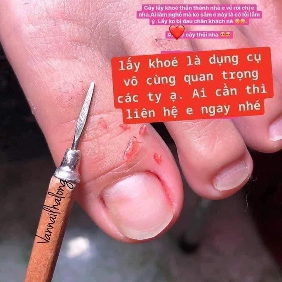 Cây lấy khóe gỗ nail