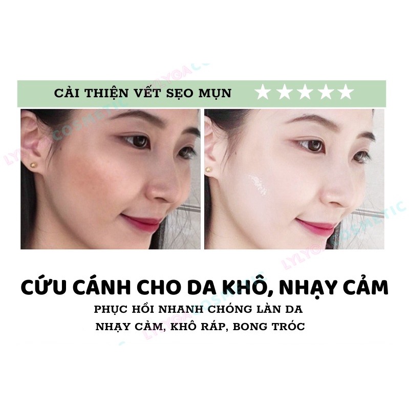 Gel Nha Đam dưỡng ẩm 99% FAZIYAN - Gel Lô Hội nội địa Trung dưỡng da, cấp ẩm cho da mặt 30gr