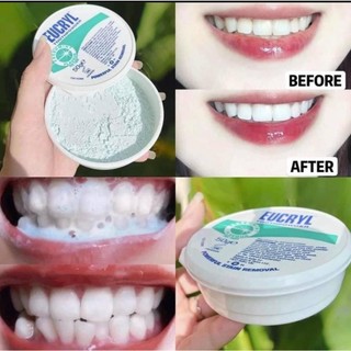 BỘT TẨY TRẮNG RĂNG EUCRYL