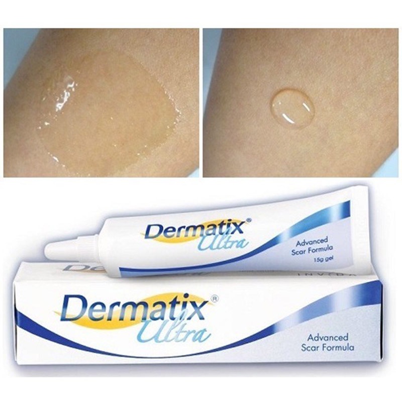 Dermatix Ultra Gel Làm Mờ Sẹo Thâm, Sẹo Lồi 15g Vết sẹo kem