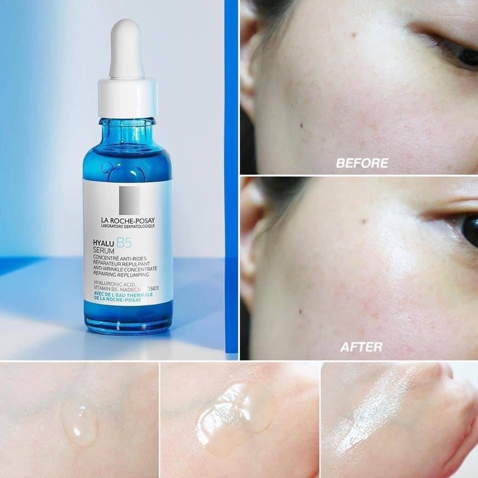 Serum La Roche-Posay B5 Hyalu Tái Tạo Và Phục Hồi Da