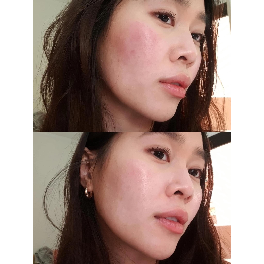 Serum La Roche-Posay B5 Hyalu Tái Tạo Và Phục Hồi Da