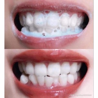 kem đánh răng 93 số 1 Hàn Quốc