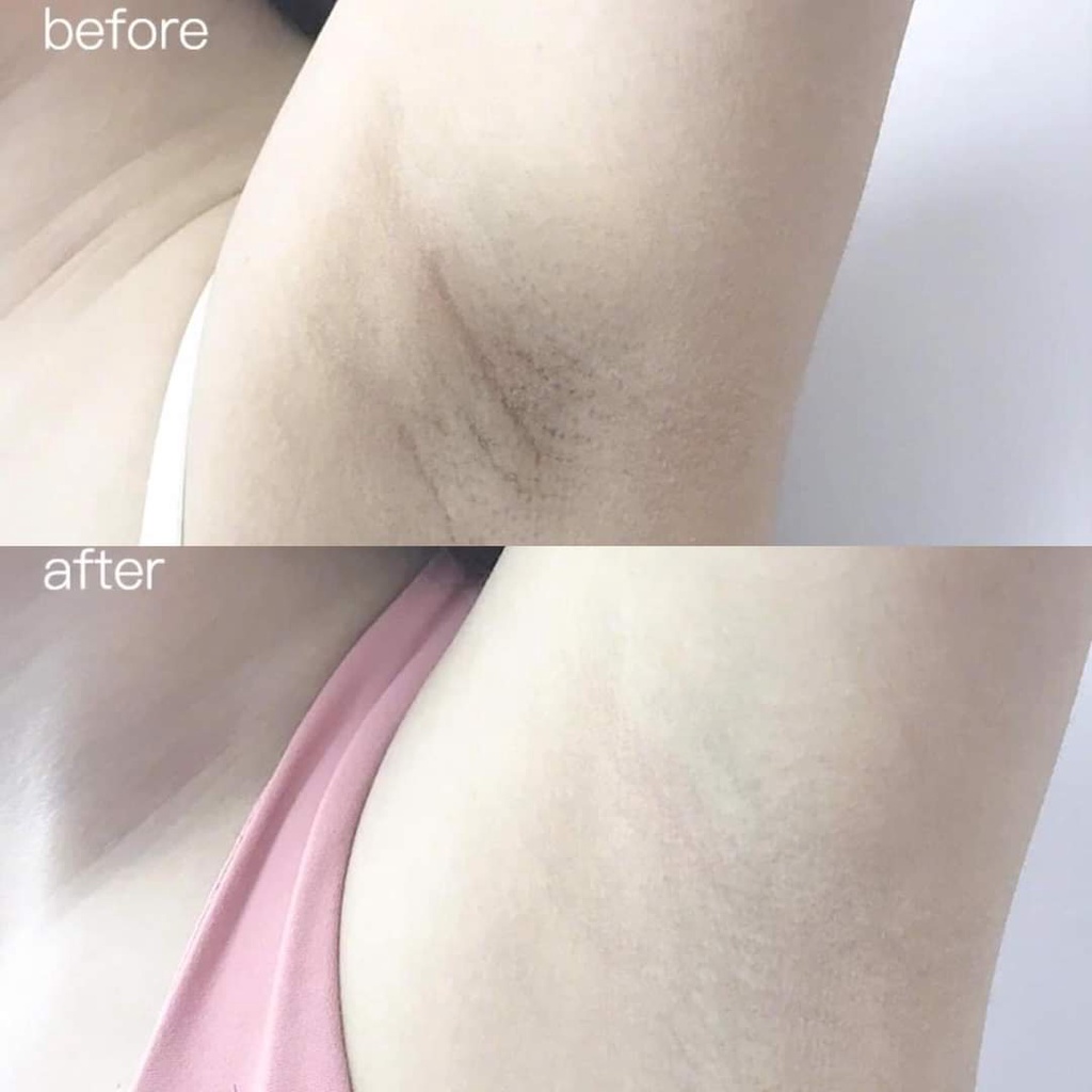 Lăn gel khử mùi hôi nách Kobayashi Nhật Bản