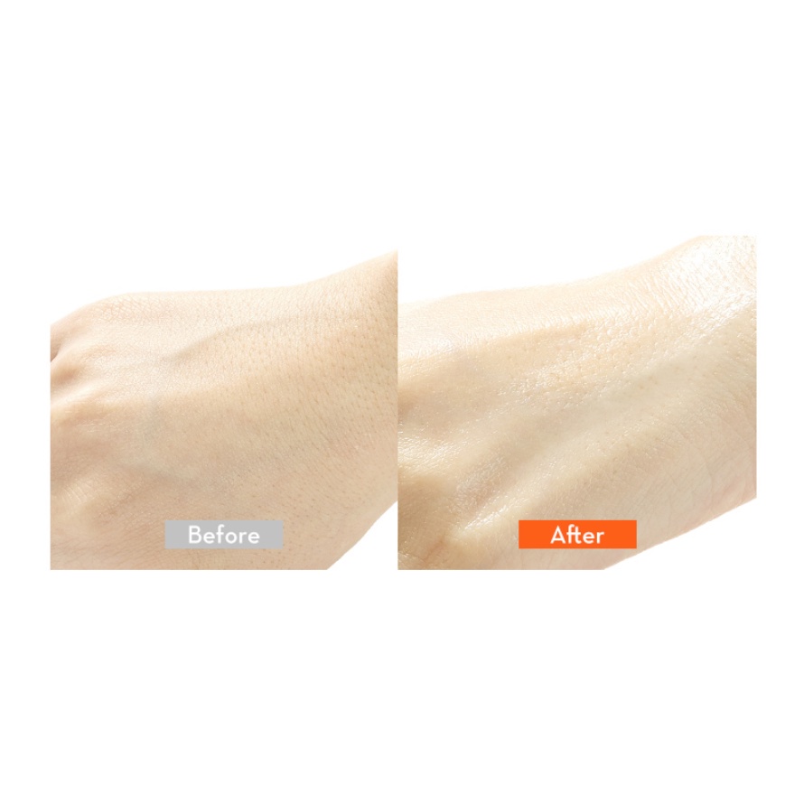 Bộ dưỡng sáng da mờ thâm Nature Republic Vita Pair C Blemish Serum Special Set