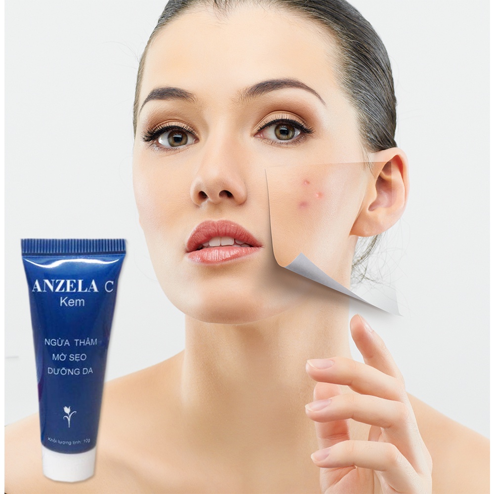 KEM MỜ SẸO, THÂM DA  ANZELA C - 10g