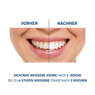 Kem đánh răng siêu trắng Perl Weiss Đức