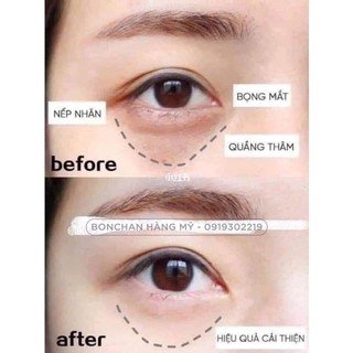 Kem mắt Estee Lauder Revitalizing Supreme+ 5ml