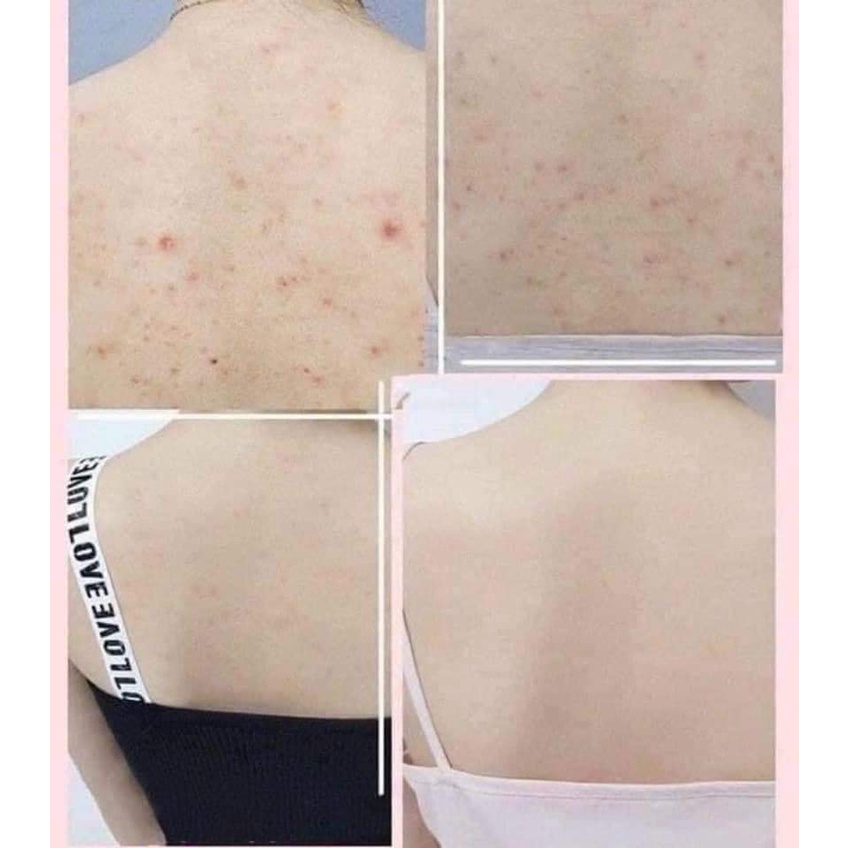 Sữa tắm Aderma Shower Gel Hydra-Protective 500ml