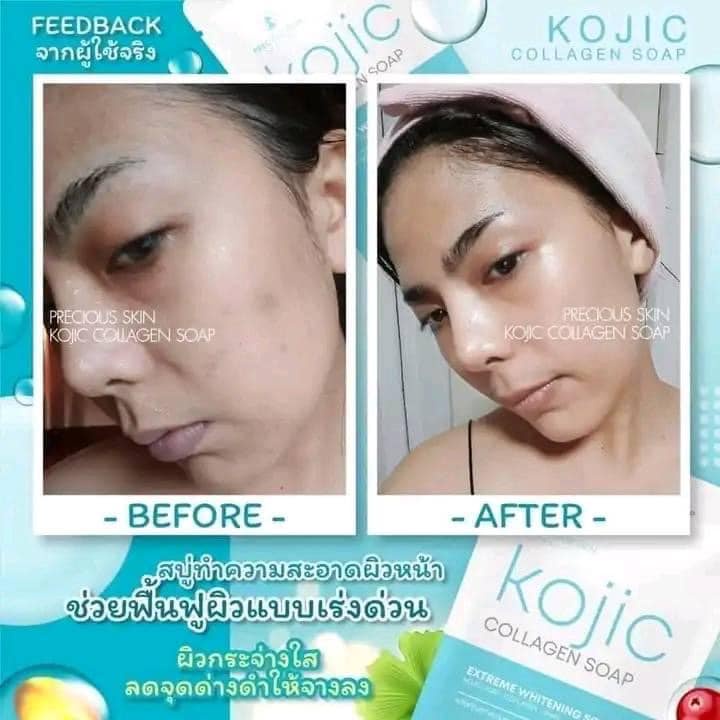 Xà phòng trắng da an toàn Kojic Collagen Soap