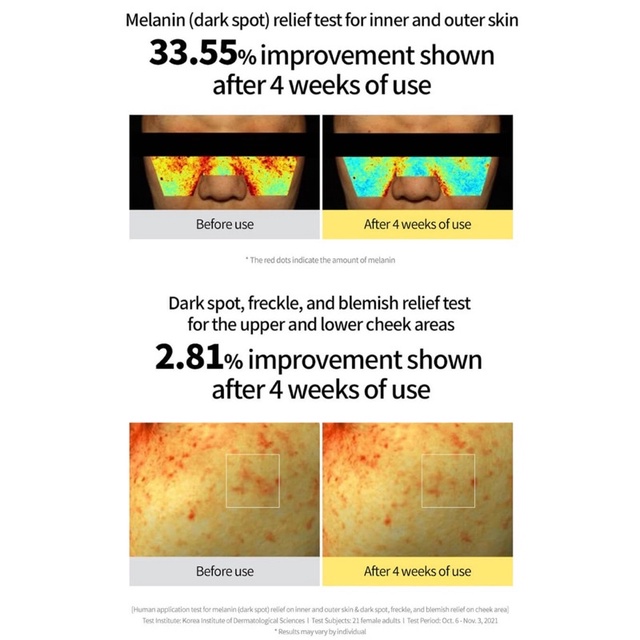 50ml  Tinh chất làm sáng da Green Tangerine Vita C Dark Spot Care Serum